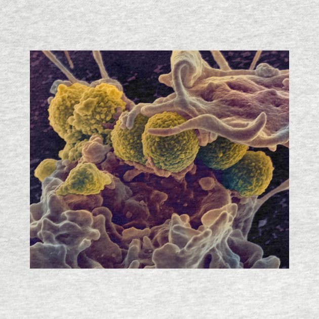 MRSA ingestion by white blood cell, SEM (C021/7464) by SciencePhoto